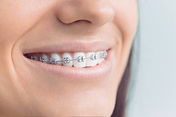 Best Dental Inlays and Onlays  in Chalfant, CA